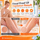 🎁💥LAST DAY SPECIAL PRICE!-￡7.99!!✨Ice-Cooling Hair Removal Cream for Sensitive Skin